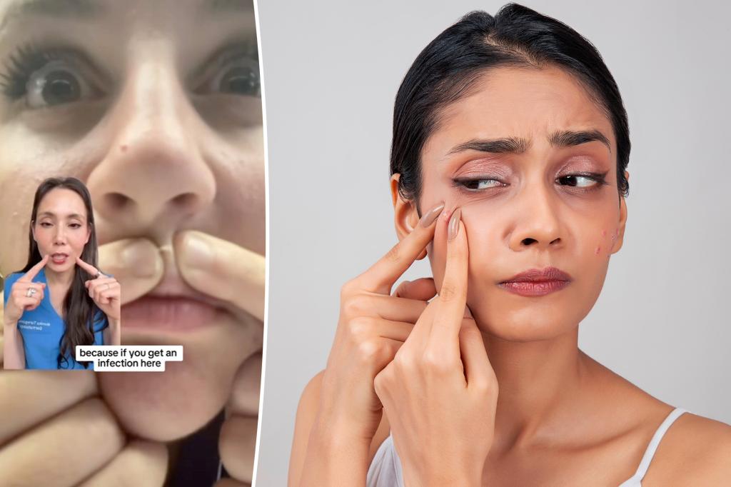 I'm a dermatologist - this is the best way to pop a pimple at home